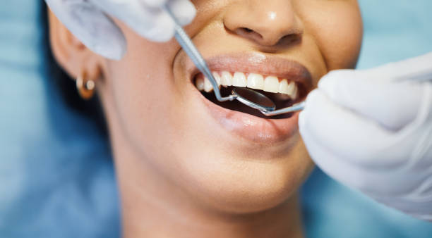 Best Broken or Chipped Tooth Repair in Santa Anna, TX